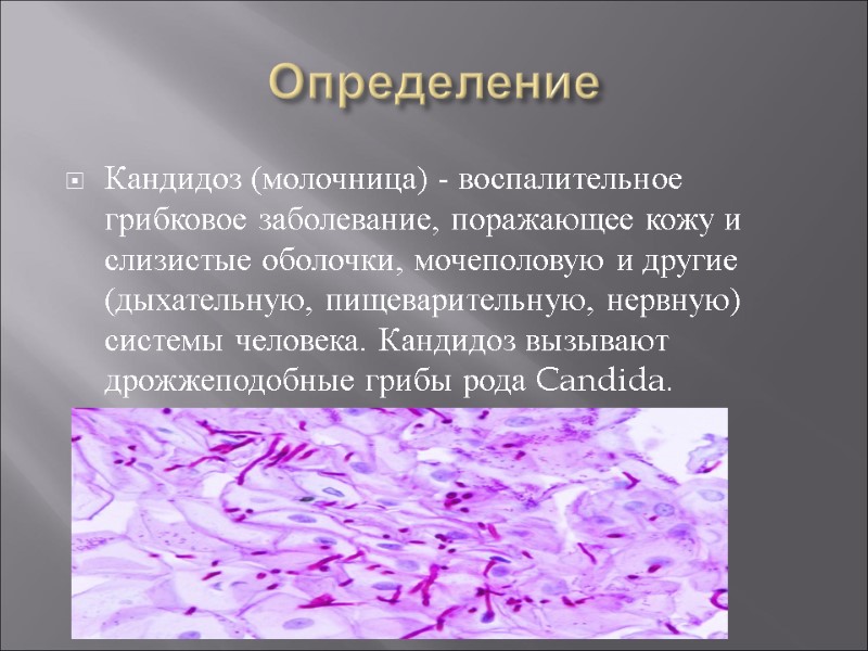 Определение Кандидоз (молочница) - воспалительное грибковое заболевание, поражающее кожу и слизистые оболочки, мочеполовую и